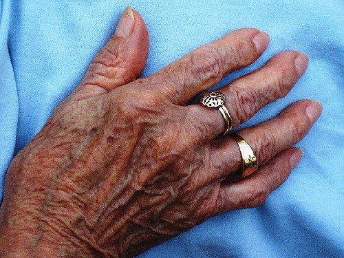 Satspuljepenge til kampen mod underernæring: Vi er blevet hørt