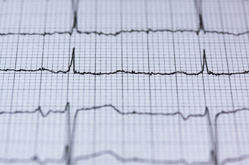 Stort forskningsprojekt skal målrette behandlingen af type 2-diabetes via ny smart insulinpen