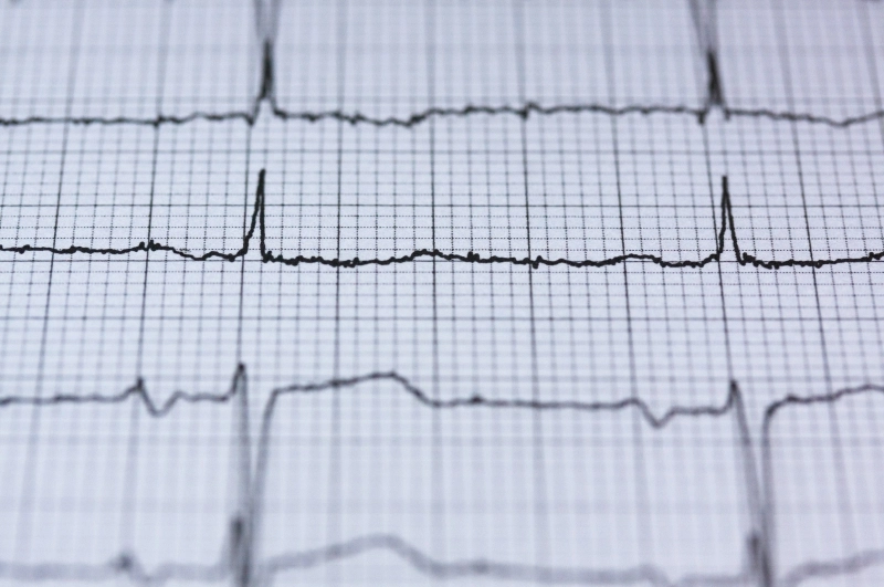 Stort forskningsprojekt skal målrette behandlingen af type 2-diabetes via ny smart insulinpen