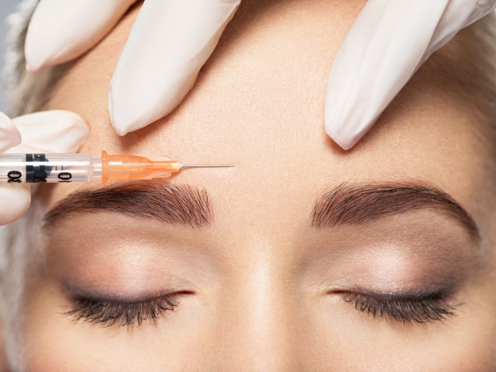 Kosmetiske alderstegn kan i dag bekæmpes med Botox og garanterer et yngre udseende uden operation