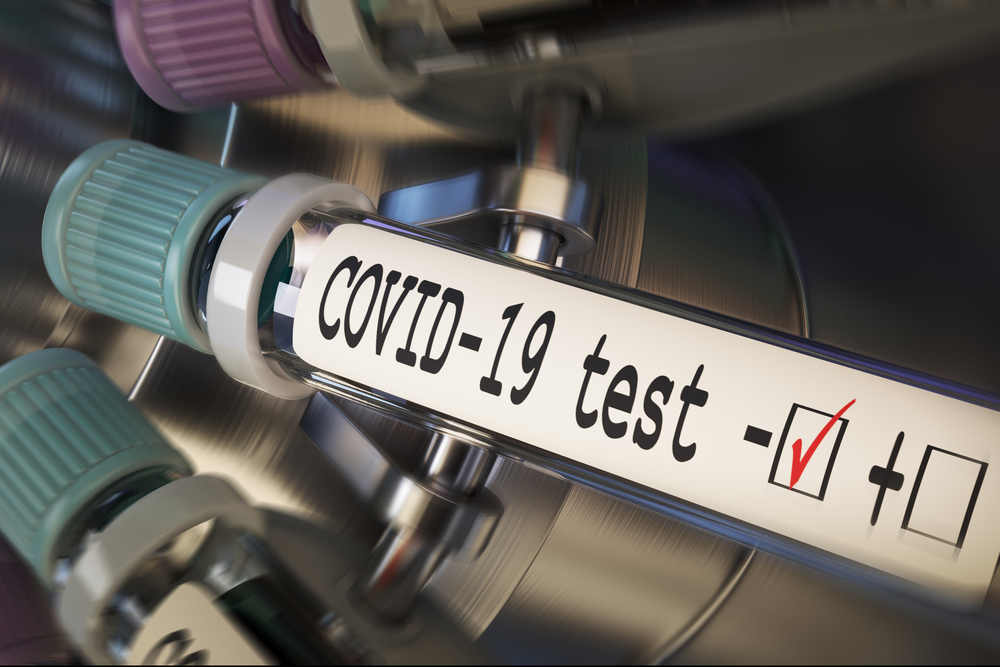 Udenlandsk arbejdskraft skal vise negativ corona-test ved grænsen
