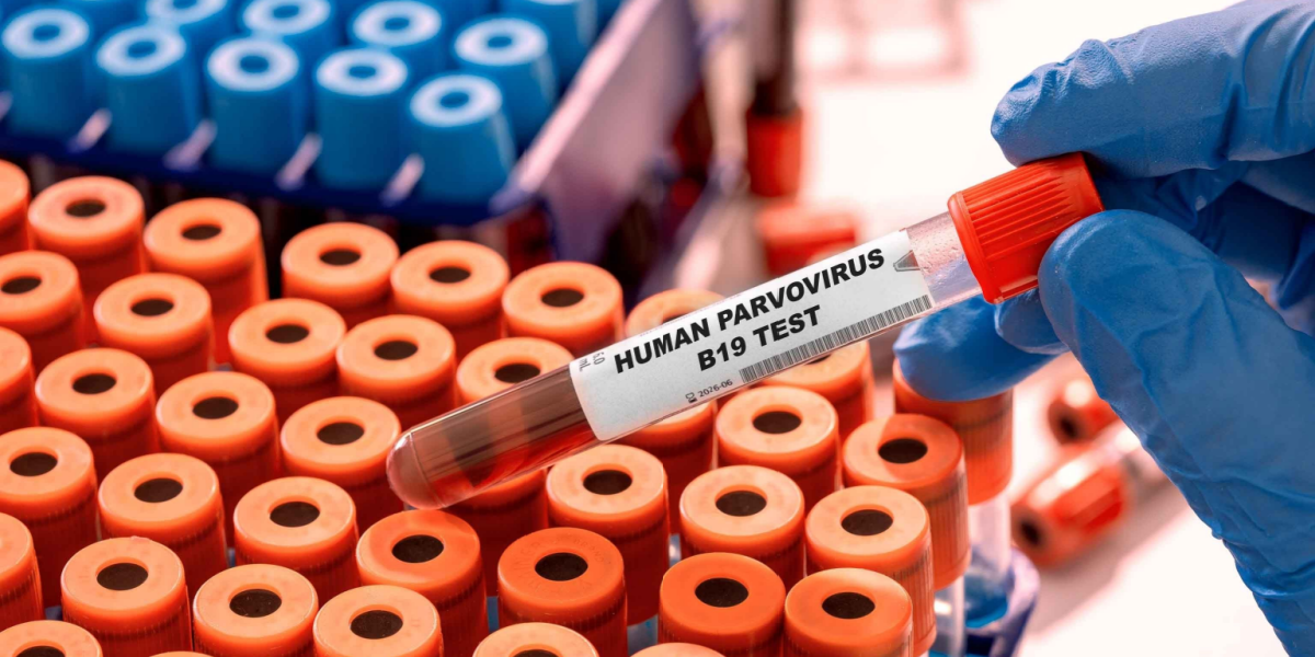 Statens Serum Institut advarer: Vi er ramt af en ny epidemi