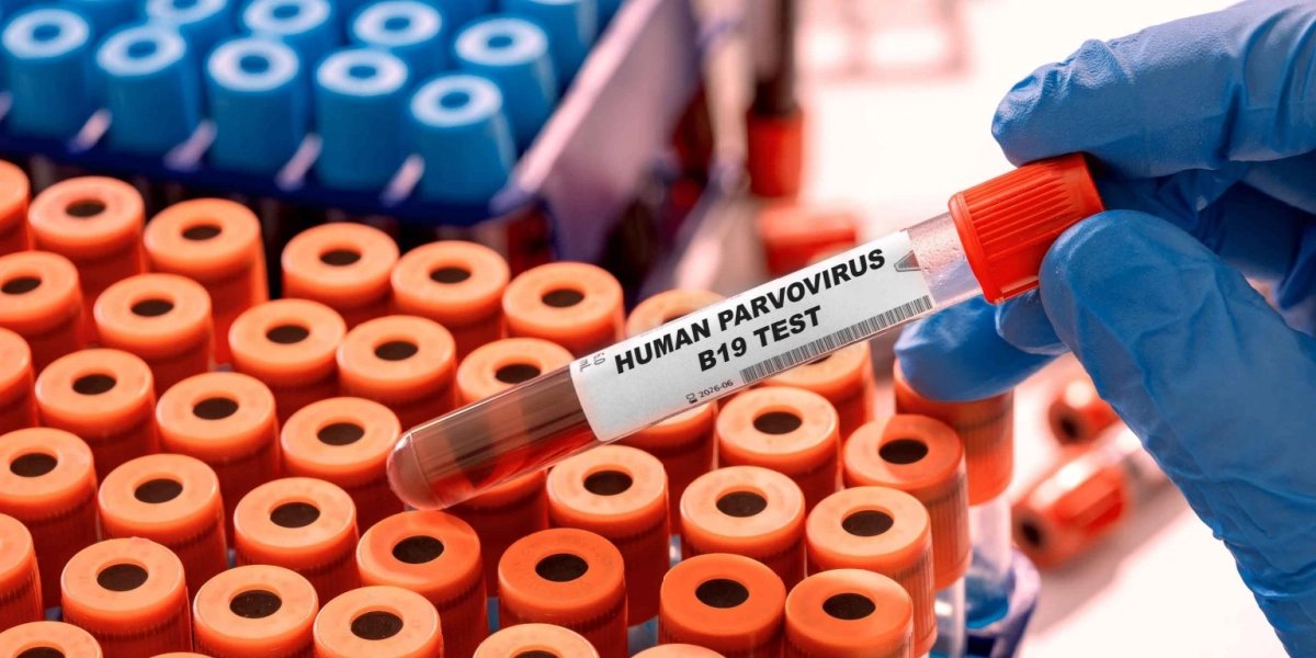 Statens Serum Institut advarer: Vi er ramt af en ny epidemi
