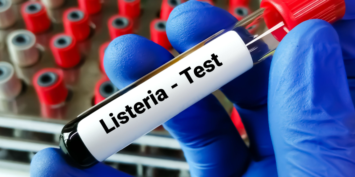 Der er fundet listeria: 2 slags pålæg kaldes tilbage