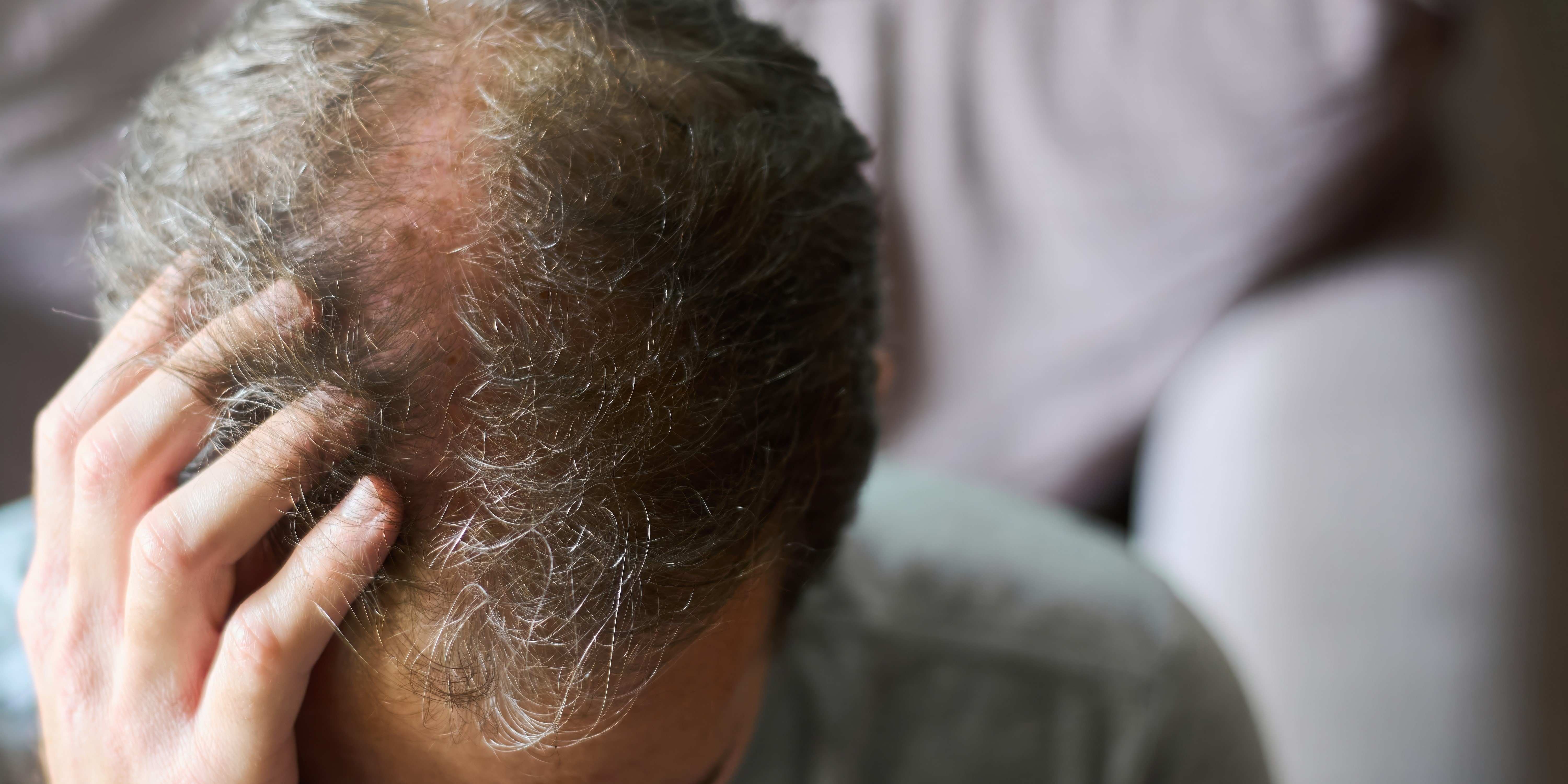 5 mulige årsager til, du er ved at miste håret