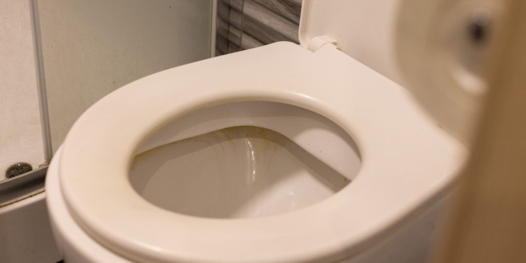 Farvel til det misfarvede toiletbræt: Sådan gør du det hvidt igen med et snuptag
