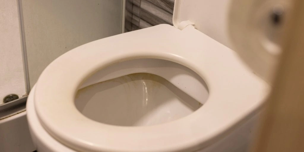 Farvel til det misfarvede toiletbræt: Sådan gør du det hvidt igen med et snuptag